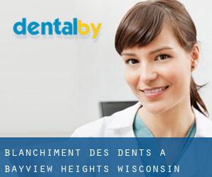 Blanchiment des dents à Bayview Heights (Wisconsin)