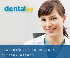 Blanchiment des dents à Clifton (Oregon)