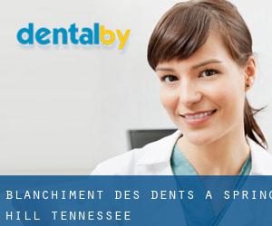 Blanchiment des dents à Spring Hill (Tennessee)