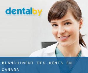 Blanchiment des dents en Canada