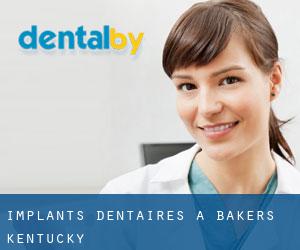 Implants dentaires à Bakers (Kentucky)