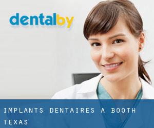 Implants dentaires à Booth (Texas)