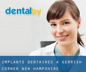 Implants dentaires à Gerrish Corner (New Hampshire)