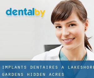 Implants dentaires à Lakeshore Gardens-Hidden Acres