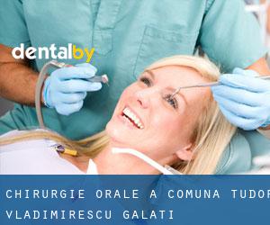 Chirurgie orale à Comuna Tudor Vladimirescu (Galaţi)
