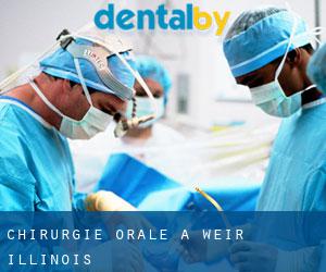 Chirurgie orale à Weir (Illinois)