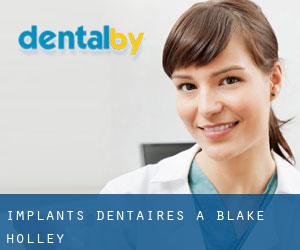 Implants dentaires à Blake Holley