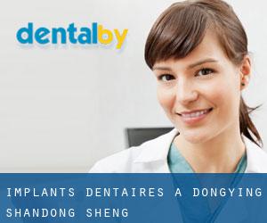Implants dentaires à Dongying (Shandong Sheng)