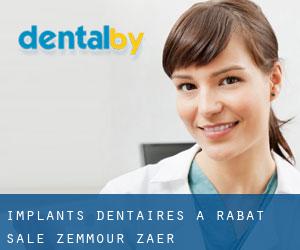 Implants dentaires à Rabat-Salé-Zemmour-Zaër