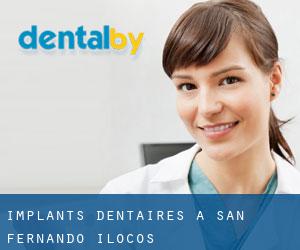 Implants dentaires à San Fernando (Ilocos)