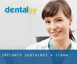 Implants dentaires à Tiana