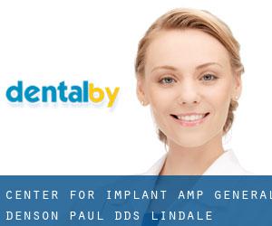 Center For Implant & General: Denson Paul DDS (Lindale)